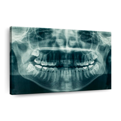 Dental X-Ray View Canvas Print