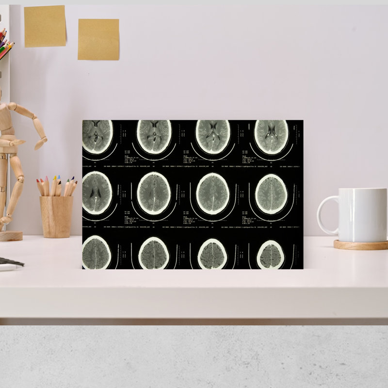 «Mri Brain Scans Abstract Contemporary Portrait Architecture», art mural, H 12 po x l 18 po
