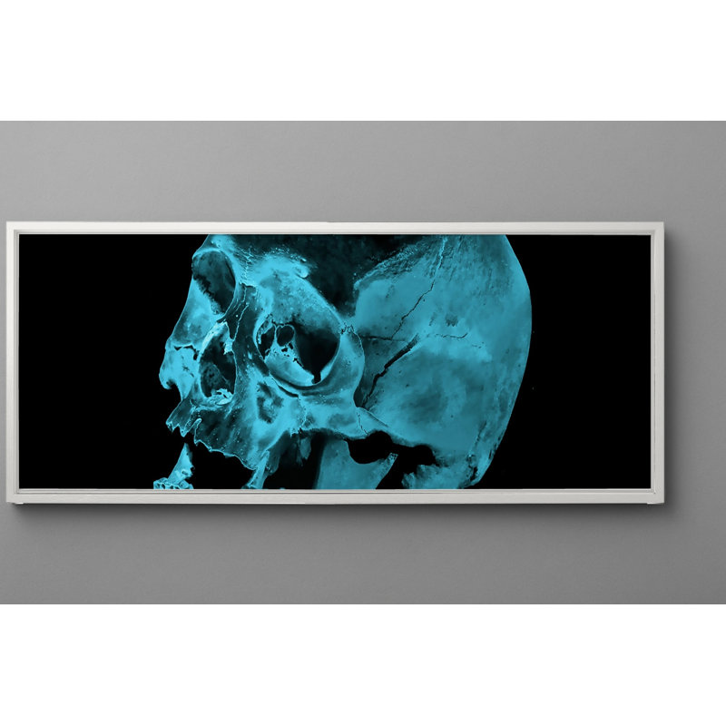 Gibbs X-Ray Photography Print, 22.5" H x 62.5" W, White