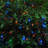 Phillips Electric String Lights with Multicolor Globes