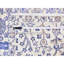 Tapis de couloir unique ivoire / bleu noué à la main 2 pi 7 po x 10 pi 1 po Frazierii