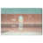 Gallery Wrapped selected