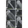 Ana Bath 6-Inch Multi Function (with Pause Function) Dual Shower Head with 5-Ft Hose