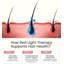 Capuchon sans fil pour soins du cuir chevelu avec luminothérapie rouge et bleue, fonction de chauffage et minuterie - réglable, rechargeable et portable pour la maison et les voyages