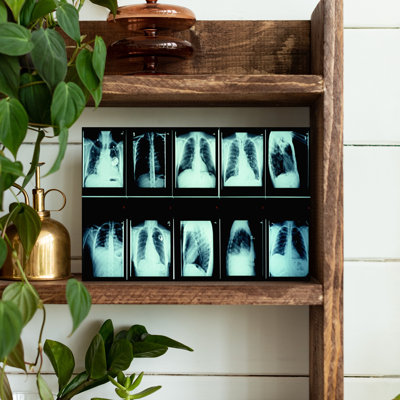 Radiographie de la commode humaine abstraite, art mural contemporain