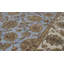 Mountain King One-of-a-Kind 6'1" X 9'2" Area Rug