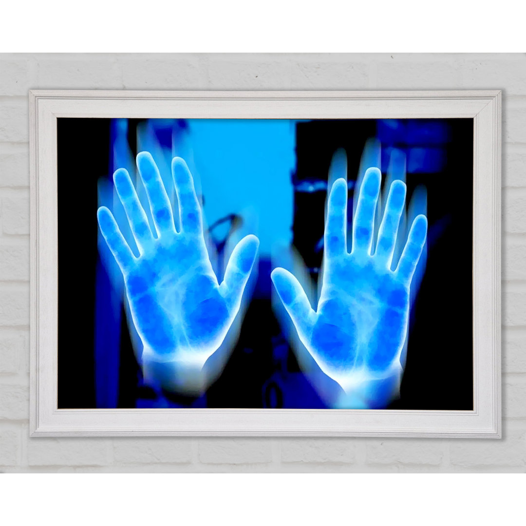 Vibrant Blue Hand Prints - Einzelne Bilderrahmen Kunstdrucke