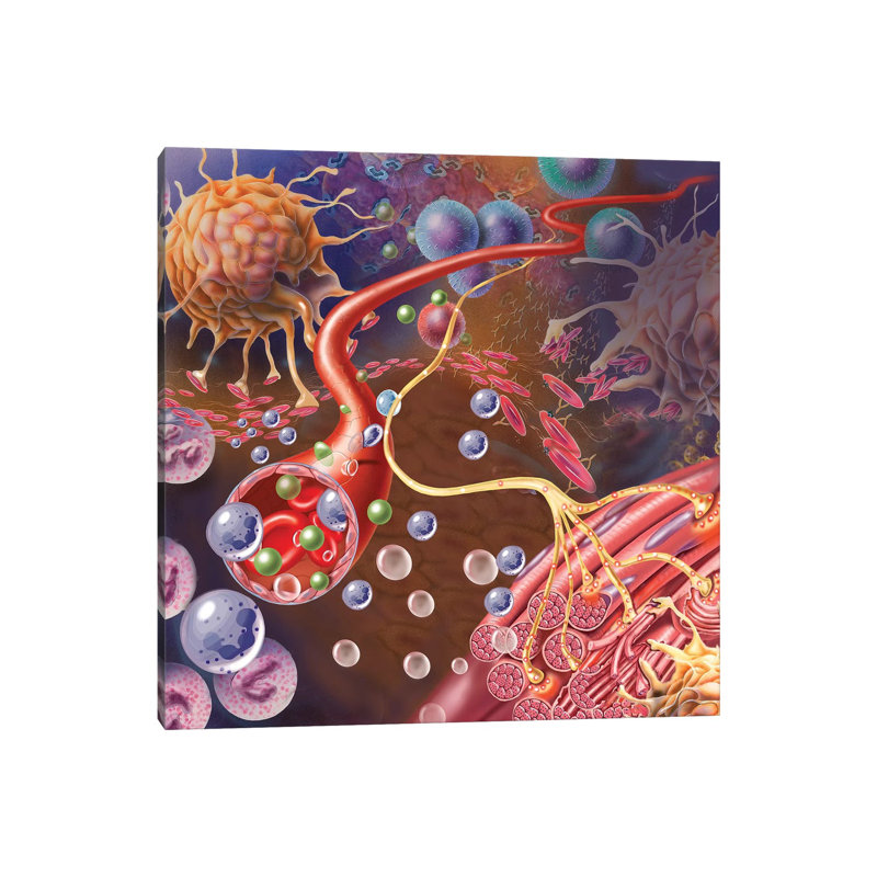 Nerve Ending, Seen in Lower Right, Sends Pain Message from Injured Muscle by TriFocal Communications - Wrapped Canvas Graphic Art