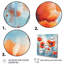 Corail vibrant coquelicots I sur toile-1008467351-1008467350