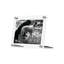 Acrylic Bevel Tabletop Float Frames-1018201708-1058463879