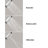 Croma Thermostatic Complete Shower System-11081031