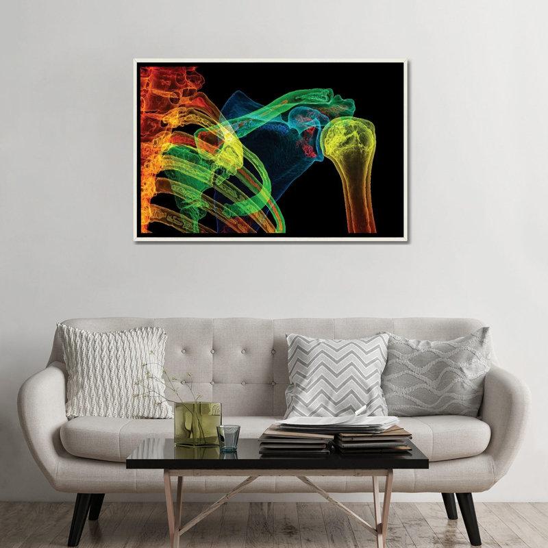 Épaule normale, tomodensitométrie 3D, reproduction d'art murale, toile encadrée, 48" x 32", Framed Canvas, Distressed White
