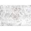 Area Rug-70228262