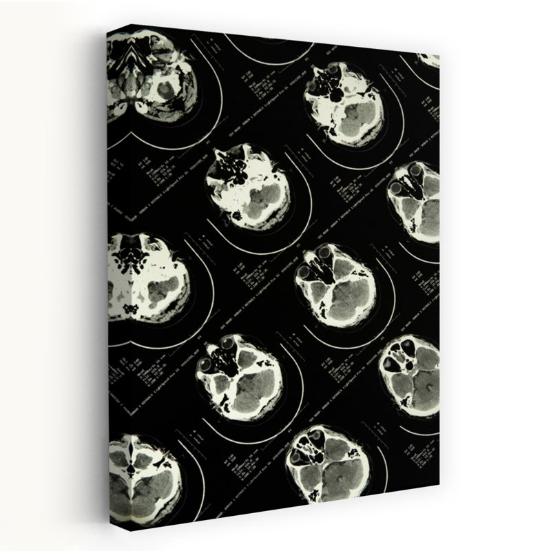 «Mri Brain Scans Abstract Contemporary Portrait Architecture», art mural, H 60 po x l 40 po