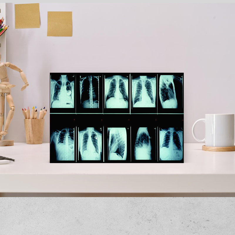 Radiographie de la commode humaine abstraite, art mural contemporain, H 12 po x l 18 po