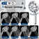 Shower Head, 7 Spray Modes Detachable Showerhead High Pressure Shower Heads With Long Hose And Adjustable Angle Bracket