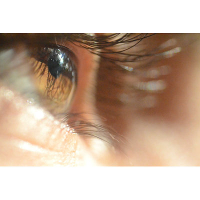 Gros plan sur un œil humain - Photographie sur toile tendue