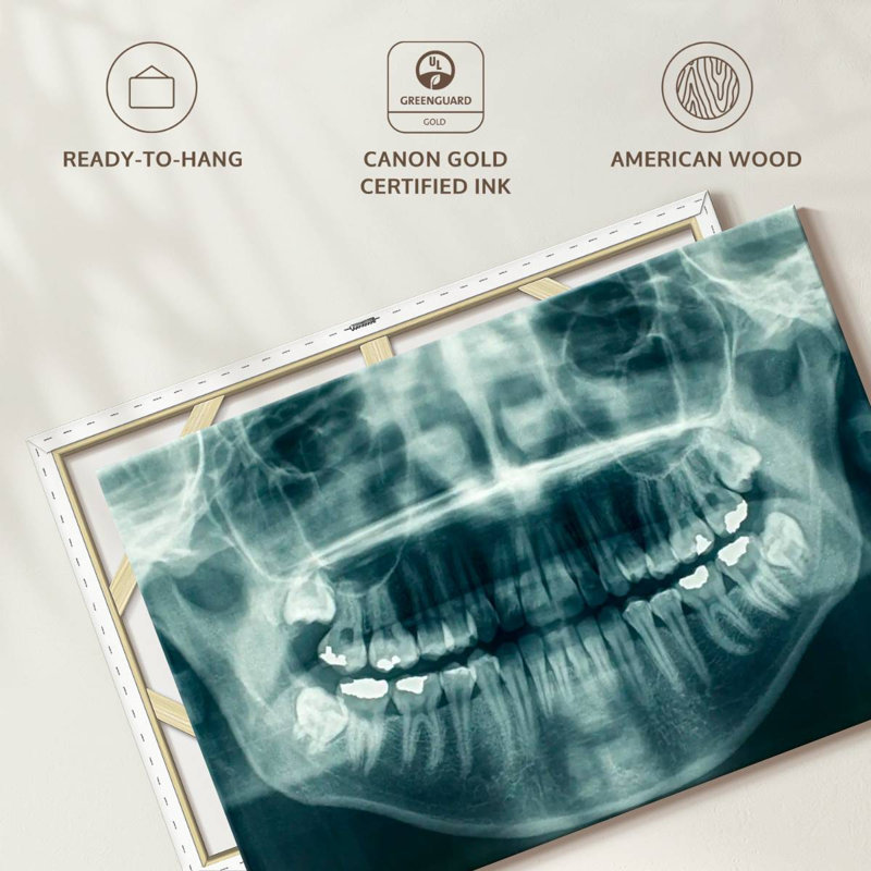 Dental X-Ray View Canvas Print, 30" W x 45" H