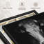 «Pondering Cow», reproduction sur toile-100689938