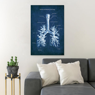«Value N'applique pas», impression sur toile tendue