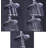 Ana Bath 6-Inch Multi Function (with Pause Function) Dual Shower Head with 5-Ft Hose-54374817