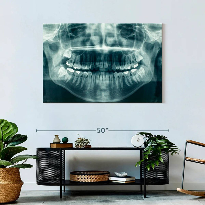 Dental X-Ray View Canvas Print, 30" W x 45" H