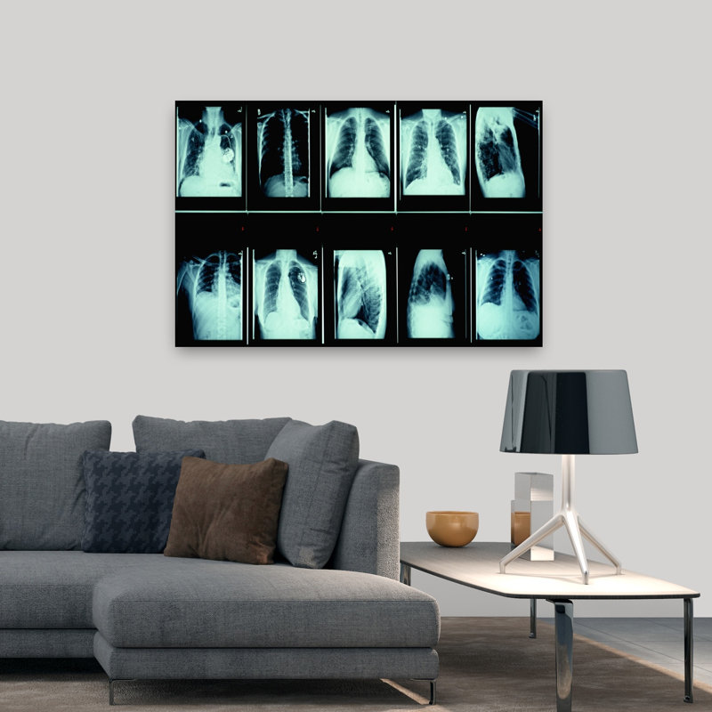 Radiographie de la commode humaine abstraite, art mural contemporain, H 32 po x l 48 po