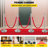 Steel and Iron Stanchion System