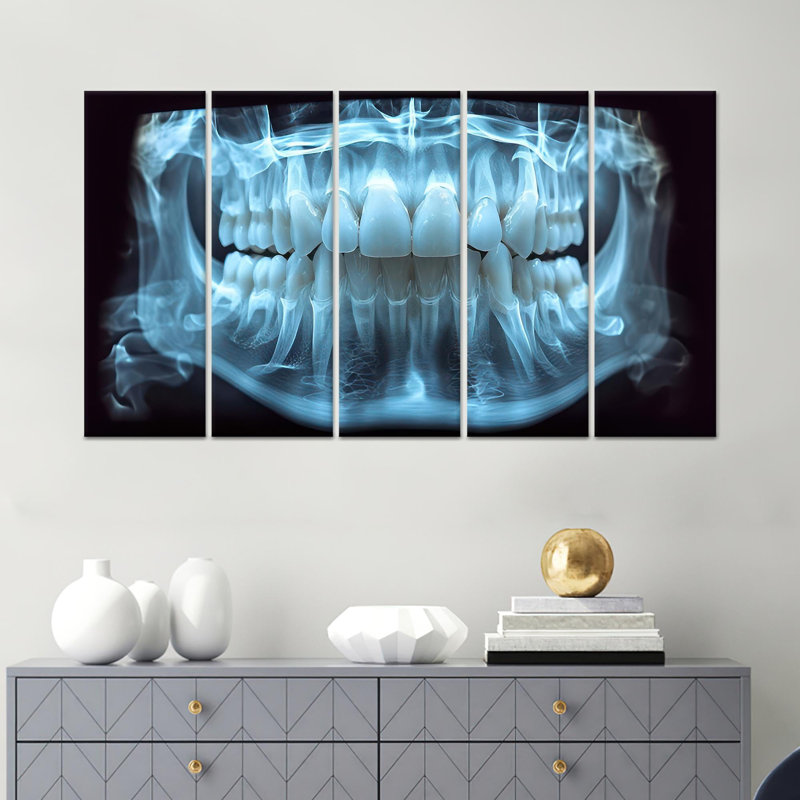 Élégante décoration de cabinet de dentiste: Toile imprimée avec motif à rayons X, toile tendue 5P, H: 59,1 po x l: 98,4 po