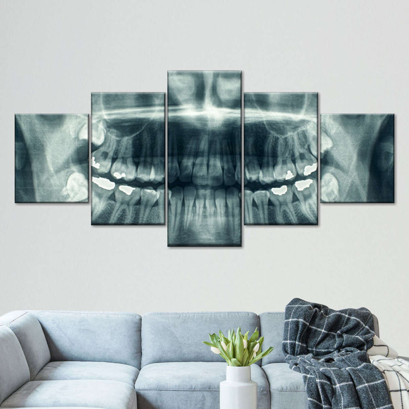 Ensemble de 5 pièces de radiographie dentaires sur toile, H 30 po x l 68 po x P 1,25 po