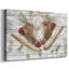 Collection Pinecone Lodge, toile tendue A-Gallery-1962528473