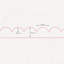 PRIMED (Pack of 2) Large Decorative Scallop Design Trim - 95 x 6cm -Edging MDF Wood (Moisture Resistant) - Dado Moulding for DIY-120081930