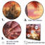 Rose radiance coucher de soleil palmiers IV-840190402-840190405