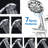 High Shower System With Tub Spout And Valve - 2 In 1 . 7 Spray Patterns Head. Dual-115806945