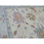 Tapis oriental turc Oushak coloré noué à la main 10 pi 4 po x 13 pi 5 po 07D279A6E7A64FC4B55999EDA11DB1C8