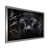 Silver Single Picture Framed