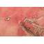 Tapis rose Antalya 7 pi 6 po x 10 pi 9 po