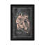 Surgical Anatomy Of The Heart by ChartSmartDecor - Floater Frame Print on Canvas-885834783-885834768