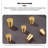 Nut-brown Solid Wood+Tempered Glass Display Cases