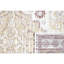 Tapis intérieur / extérieur Bentzel-1836364558