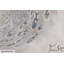 Closing Gap 1 Piece Painting on Canvas