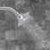 5" Round Thin 5-Function Adjustable Spray Shower Head with 8" Wall Mount Arm