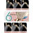 Filtered Shower Head With Handheld, 6 Spray Modes, Water Purifier Filters, For Soft Water And Healthy Skin