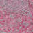 Vexira Pink Washable Indoor-Outdoor Rug - LOOMLAN-1209674215