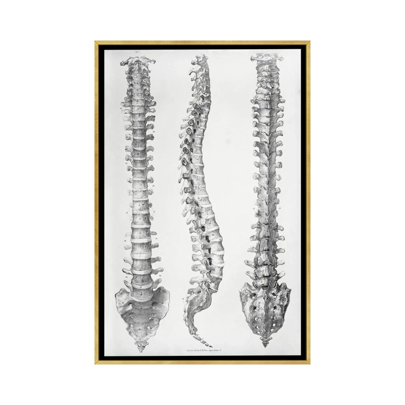 Spine Anatomy - reproduction d'art murale - toile encadrée, 40" x 26", Framed Canvas, Gold