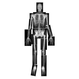 True to Life Human X-rays Educational Tool