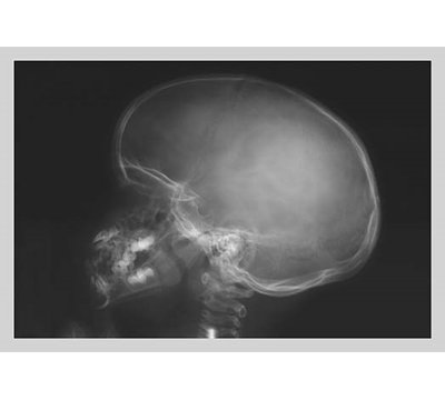Skull Photographic Print