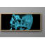 Gibbs X-Ray Photography Print-1513008518-1513008523