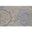 Neo Villa Abstract Area Rug