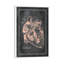 Surgical Anatomy Of The Heart by ChartSmartDecor - Floater Frame Print on Canvas-885834780-885834782